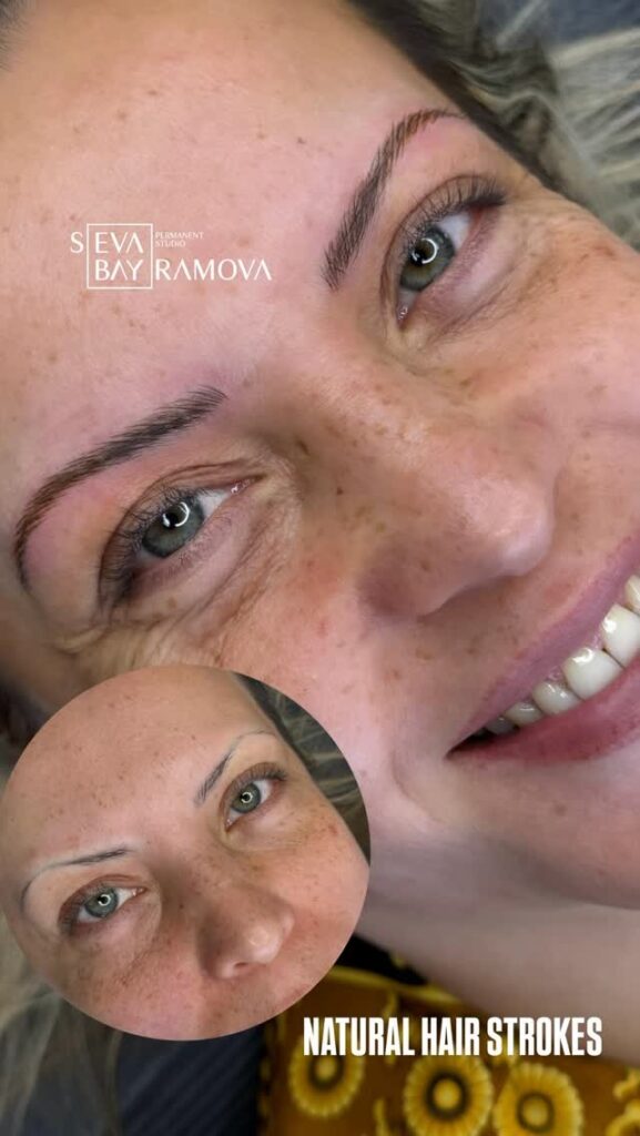 Transform Your Lips with Dark Lip Neutralization in Beverly Hills