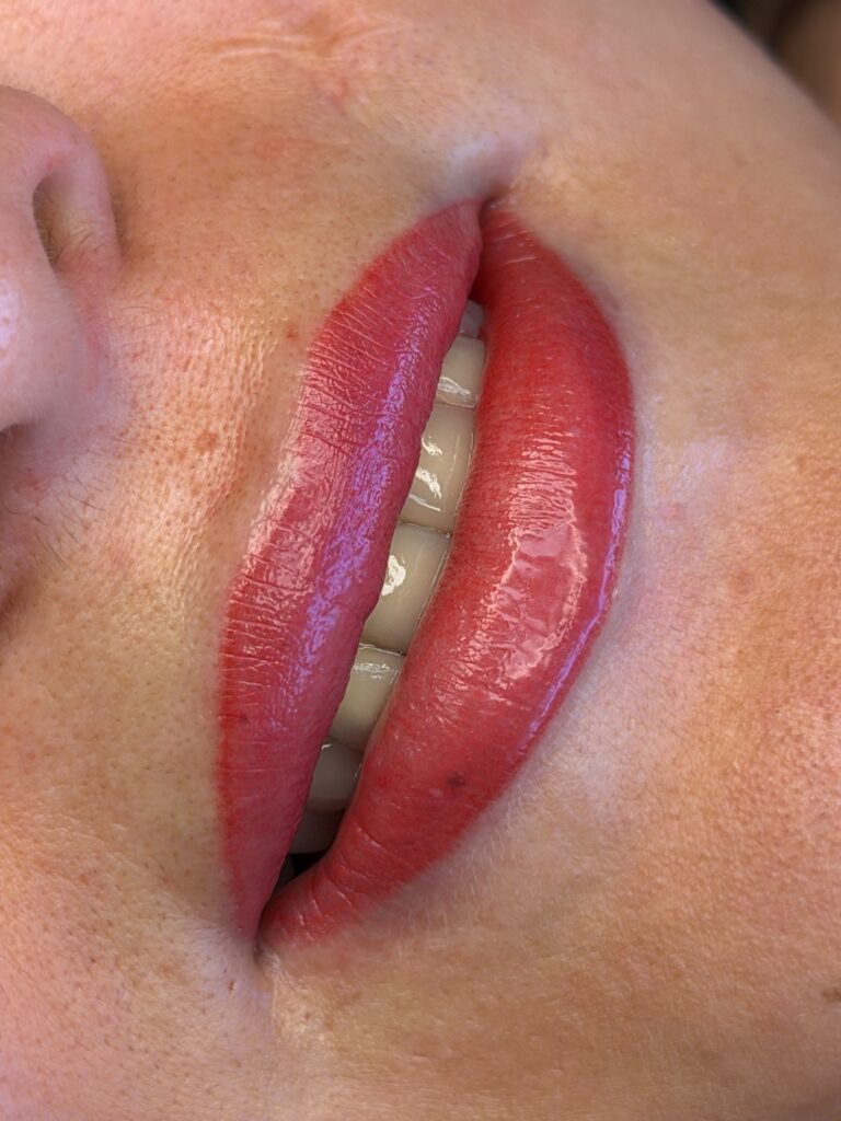 Transform Your Lips with Dark Lip Neutralization in Beverly Hills
