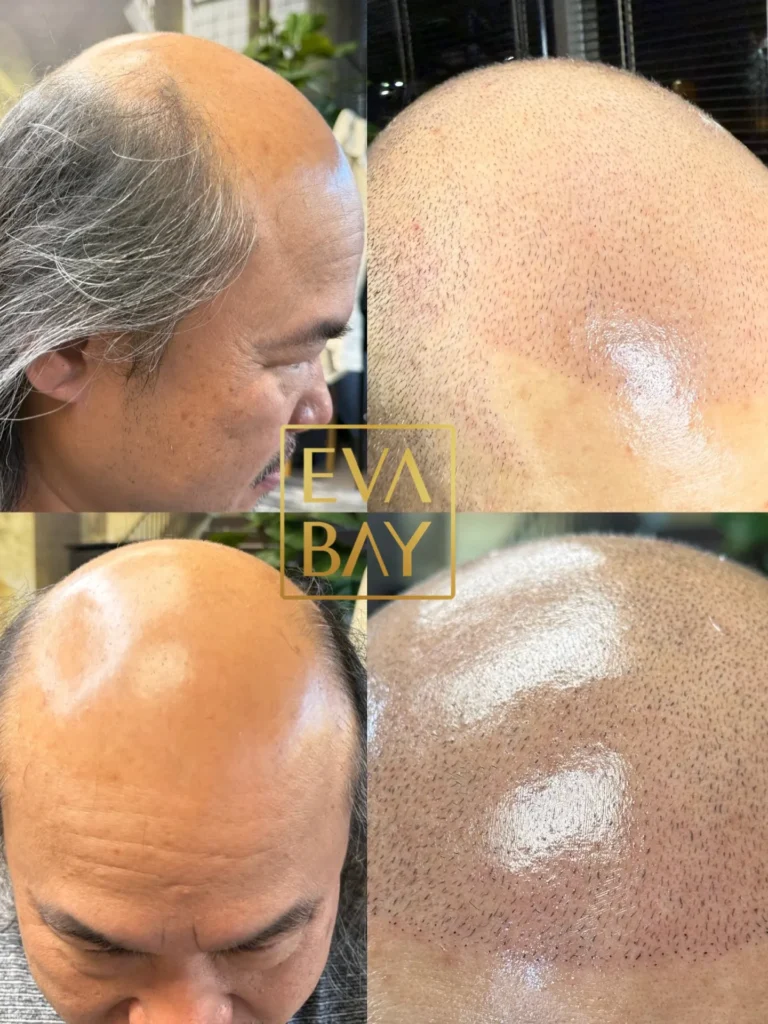 EVA Bay Studio & Aesthetics San Jose & Beverly Hills