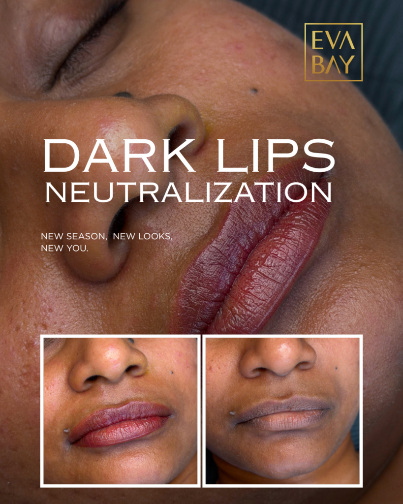 Dark Lips Neutralization in Beverly Hills & San Jose Eva Bay Aesthetic